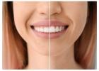 Dentist in Fort Worth for Comprehensive Dental Care